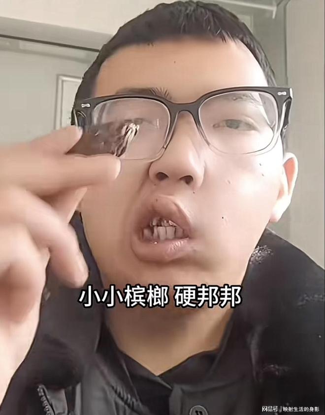 脸部变形还边嚼边劝大家别碰槟榔m6米乐注册男子嚼槟榔七年导致